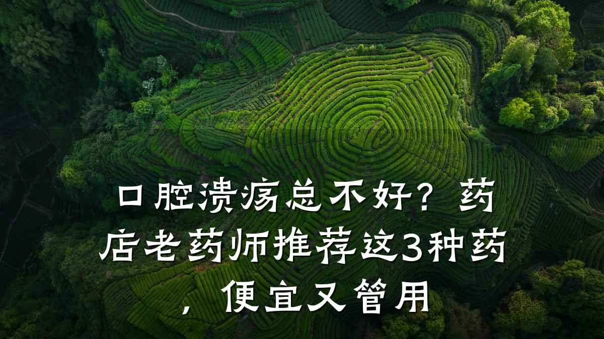 口腔溃疡总不好?药店老药师推荐这3种药,便宜又管用